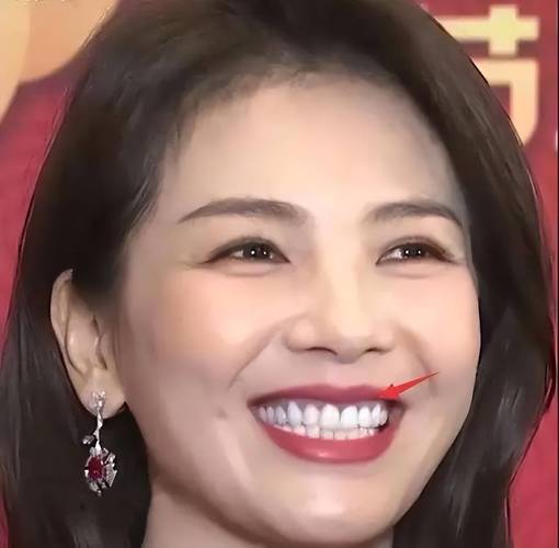 AI火眼金睛看穿烤瓷牙？辽宁春晚女星假牙现原形