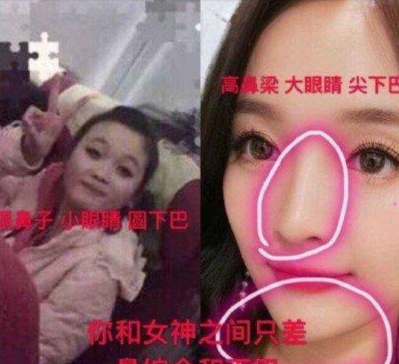 混血女明星鼻子_娱乐圈整容美女_美女整容前后对比