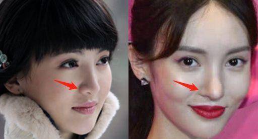 美女整容前后对比_混血女明星鼻子_娱乐圈整容美女