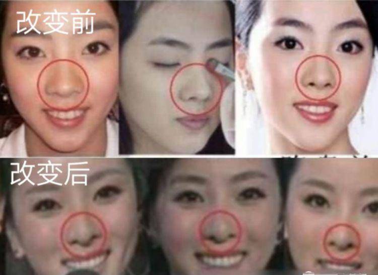 娱乐圈整容美女_美女整容前后对比_混血女明星鼻子